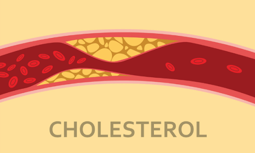 Kiem-soat-cholesterol-mau-giup-cai-thien-tinh-trang-suy-than-do-1 (1).png
